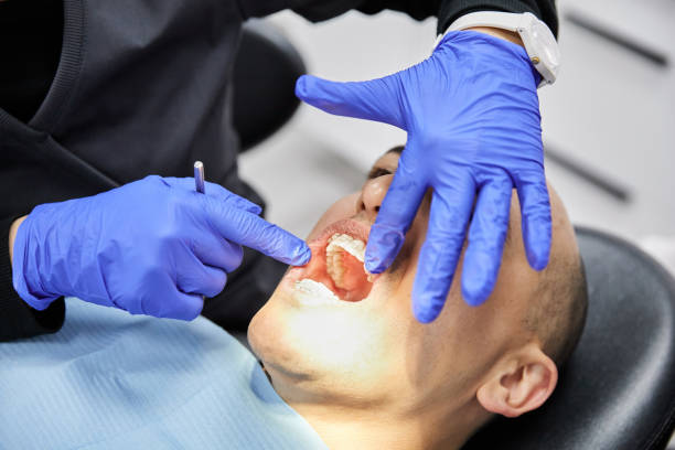Best Urgent Care for Lost Fillings or Crowns in Elkton, MD