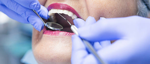 Best Emergency Gum Treatment in Elkton, MD